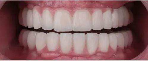 After 2